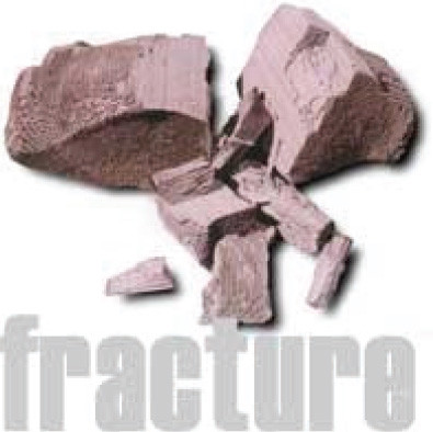 Fracture