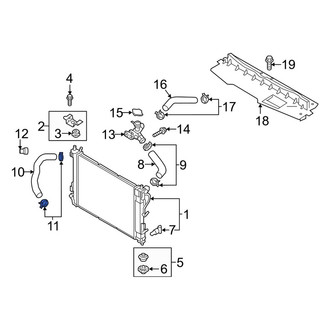 Kia OE - Lower Radiator Hose Clamp